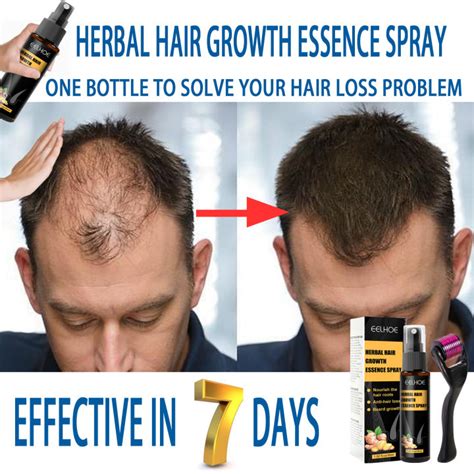 hairtech hair grower|9 Best Hair Growth Products for Hair Loss for 2025